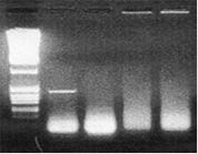 질병 유무 판별